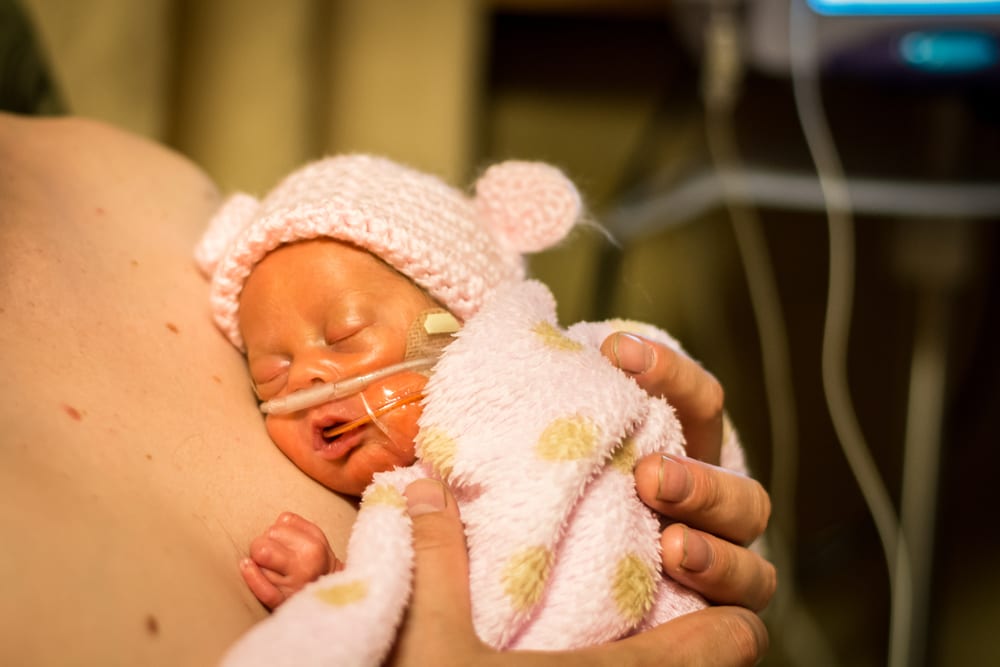 The Power Of Touch For Premature Babies - Newborns