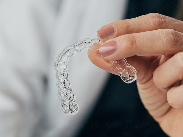 Alignerco review - at home aligners 1