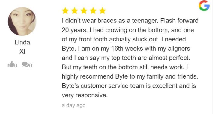 Byte review - all day vs at night aligner review
