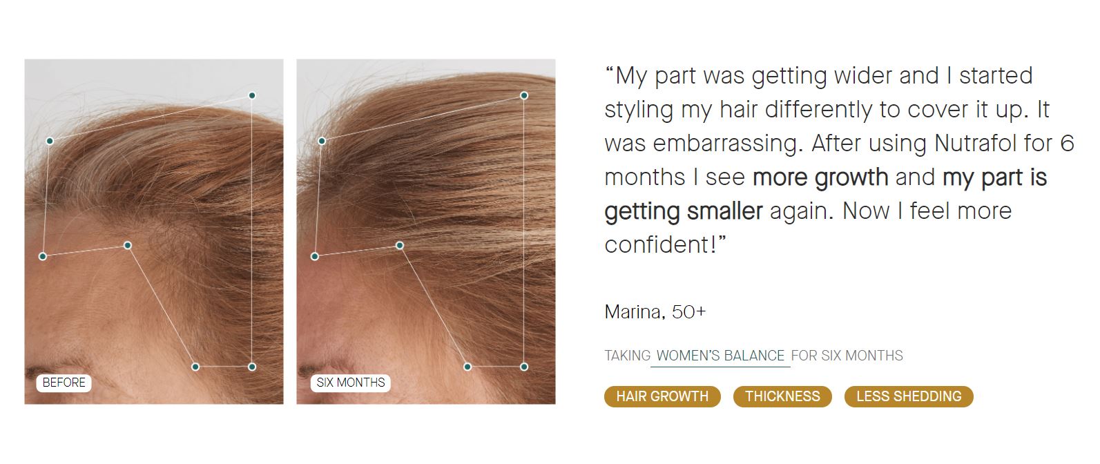 Viviscal or Nutrafol, Which Supplements Are Best for Women's Hair Loss?