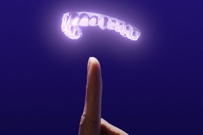 Smile Direct Club Nighttime Aligners
